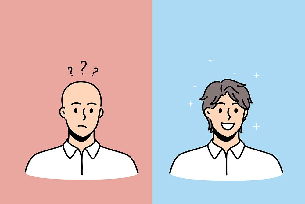¿Puede una disminución en la salud mental causar pérdida de cabello?